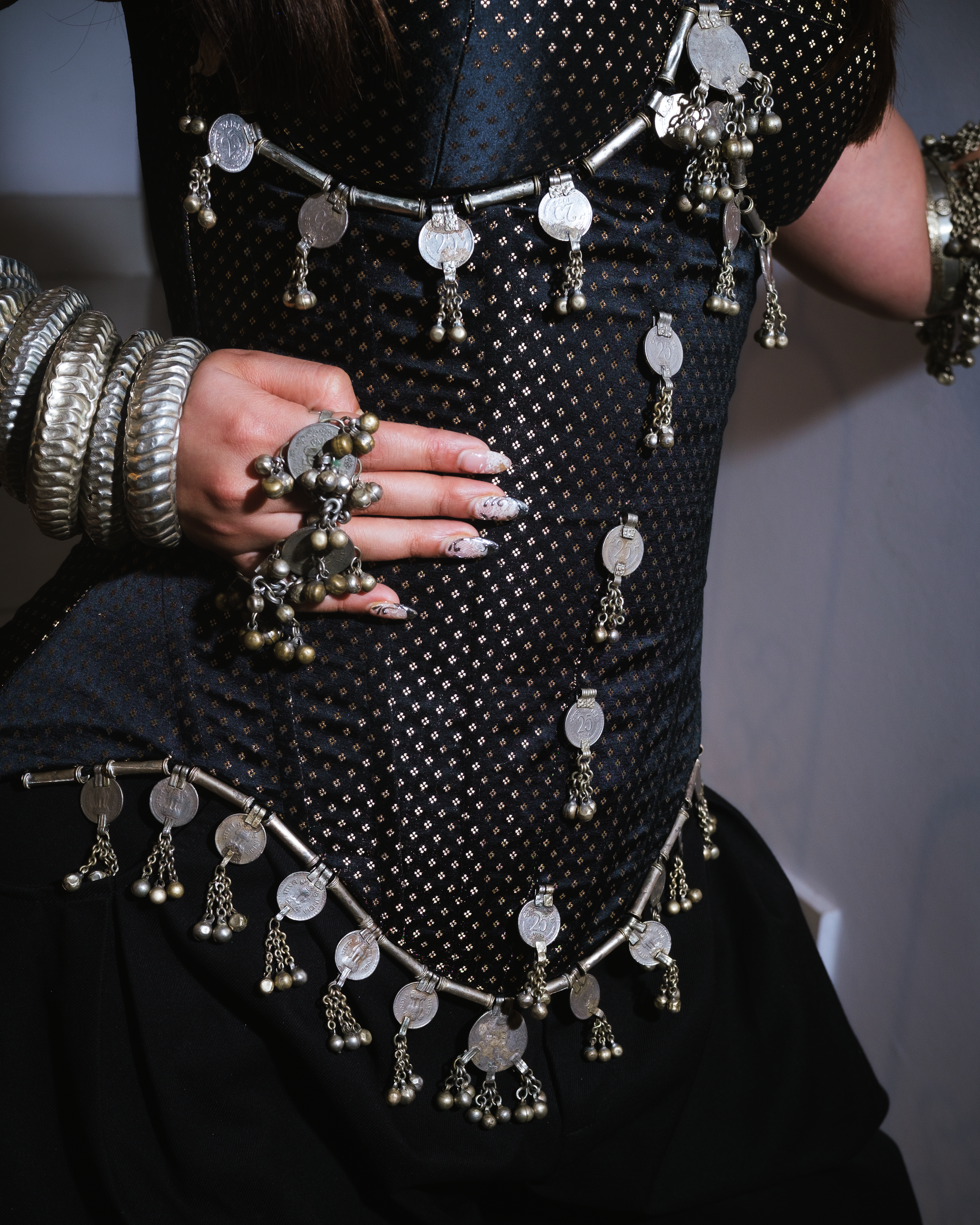 Chandra corset